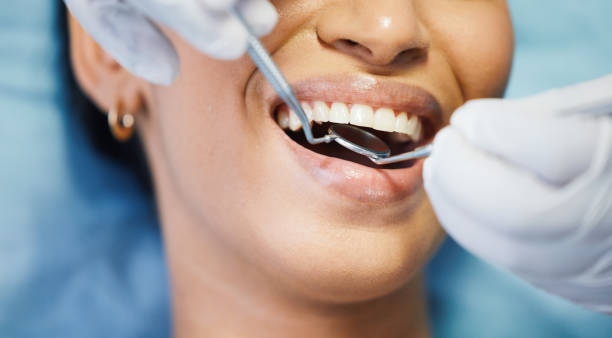 Best Emergency Root Canal Treatment in Kountze, TX
